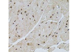 Immunohistochemistry of paraffin-embedded Mouse heart using PPP2R5C Polyclonal Antibody at dilution of 1:100 (40x lens). (PPP2R5C anticorps)