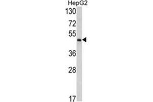 Western blot analysis of OTC Antibody (Center) in HepG2 cell line lysates (35ug/lane). (OTC anticorps  (Middle Region))