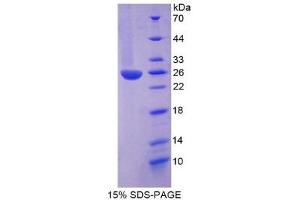SDS-PAGE (SDS) image for Inter alpha Globulin Inhibitor H3 (ITIH3) (AA 279-467) protein (His tag) (ABIN2125350)