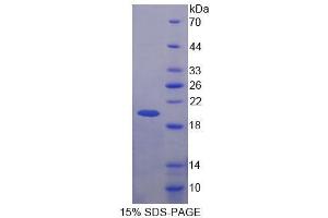 SDS-PAGE analysis of Human BRCC3 Protein. (BRCC3 Protéine)