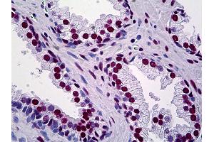 Anti-TRIM28 antibody IHC of human prostate. (KAP1 anticorps  (AA 379-524))