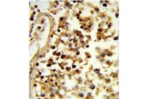 Formalin-fixed and paraffin-embedded human testis tissue reacted with IL31 Antibody (N-term), which was peroxidase-conjugated to the secondary antibody, followed by DAB staining.