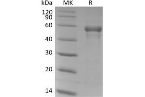 Western Blotting (WB) image for beta-1,3-Glucuronyltransferase 1 (Glucuronosyltransferase P) (B3GAT1) protein (His tag) (ABIN7319929)