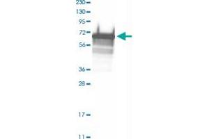 Western Blot analysis of RT-4 cell lysate with LAD1 polyclonal antibody . (Ladinin 1 anticorps)