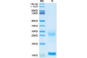 Biotinylated Human TSLP on Tris-Bis PAGE under reduced conditions.