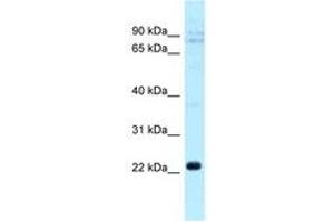 Image no. 1 for anti-C-Type Lectin Domain Family 5, Member A (CLEC5A) (AA 110-159) antibody (ABIN6747837) (CLEC5A anticorps  (AA 110-159))