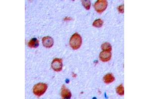 Immunohistochemical analysis of GLUR2 (pS880) staining in human brain formalin fixed paraffin embedded tissue section.