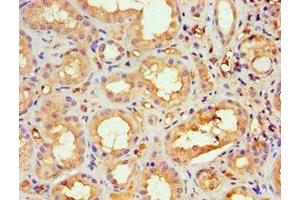 Immunohistochemistry of paraffin-embedded human kidney tissue using ABIN7169428 at dilution of 1:100 (ASH2L anticorps  (AA 329-628))