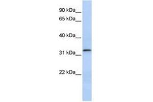 Image no. 1 for anti-Lactamase, beta 2 (LACTB2) (AA 107-156) antibody (ABIN6741397) (LACTB2 anticorps  (AA 107-156))