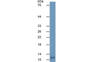 Mouse Capture antibody from the kit in WB with Positive Control:  Human Brain Tissue.