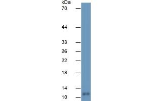 Mouse Capture antibody from the kit in WB with Positive Control:  Human Brain Tissue. (S100B Kit ELISA)