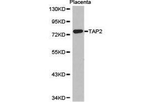Western Blotting (WB) image for anti-Transporter 2, ATP-Binding Cassette, Sub-Family B (MDR/TAP) (TAP2) antibody (ABIN1875021)