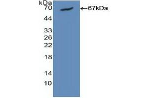Western blot analysis of recombinant Human CALM1. (Calmodulin 1 anticorps  (AA 1-149))