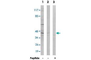 Western blot analysis of extracts from HT-29 cells (Lane 1 and lane 3) and LoVo cells (Lane 2), using ABHD8 polyclonal antibody . (ABHD8 anticorps)