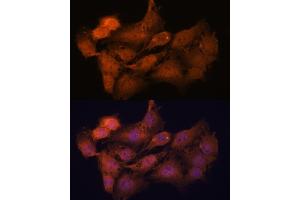 Immunofluorescence analysis of C6 cells using SYCP2 antibody (ABIN7270668) at dilution of 1:100.