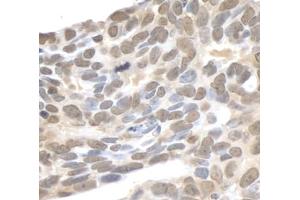 Immunohistochemistry (IHC) image for anti-Xeroderma Pigmentosum, Complementation Group A (XPA) (AA 1-50) antibody (ABIN7448868)