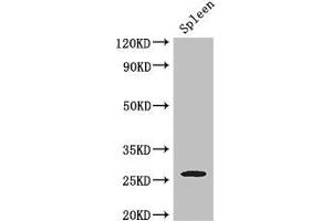 Western Blot Positive WB detected in: Mouse spleen tissue All lanes: ZC4H2 antibody at 3 μg/mL Secondary Goat polyclonal to rabbit IgG at 1/50000 dilution Predicted band size: 27, 16, 24, 21, 26 kDa Observed band size: 27 kDa (ZC4H2 anticorps  (AA 1-224))