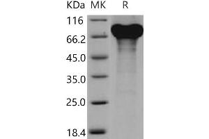 Western Blotting (WB) image for Granulin (GRN) protein (His tag) (ABIN7320292) (Granulin Protein (GRN) (His tag))