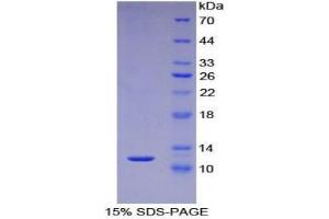 SDS-PAGE analysis of Human S100A5 Protein. (S100A5 Protéine)