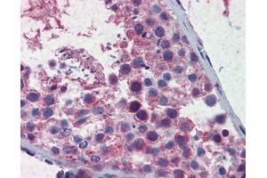 anti-Structural Maintenance of Chromosomes 3 (SMC3) (C-Term) antibody