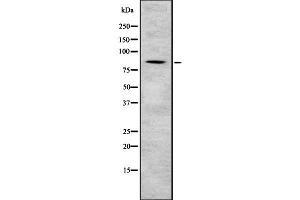 Western blot analysis Sec23B using NIH-3T3 whole cell lysates (Sec23 Homolog B anticorps  (Internal Region))