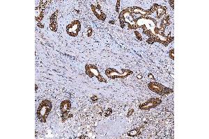 IHC analysis of SCO1 using anti-SCO1 antibody (ABIN7600609). (SCO1 anticorps  (AA 21-301))
