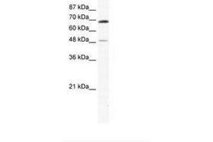 Image no. 1 for anti-Zinc Finger Protein 35 (ZNF35) (AA 33-82) antibody (ABIN6736027) (ZNF35 anticorps  (AA 33-82))