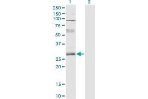 Western Blot analysis of ZNF138 expression in transfected 293T cell line by ZNF138 monoclonal antibody (M01), clone 4D11. (ZNF138 anticorps  (AA 151-251))