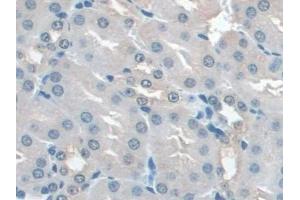 Detection of IL22Ra2 in Mouse Kidney Tissue using Polyclonal Antibody to Interleukin 22 Receptor Alpha 2 (IL22Ra2) (IL22RA2 anticorps  (AA 31-223))