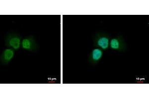ICC/IF Image NBS1 antibody detects NBS1 protein at nucleus by immunofluorescent analysis.