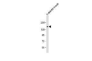 Anti-AGL Antibody (M15) at 1:1000 dilution + human skeletal muscle lysate Lysates/proteins at 20 μg per lane. (AGL anticorps  (N-Term))