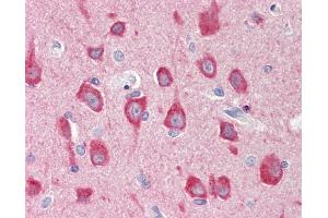 Anti-MAP1LC3B / LC3B antibody IHC staining of human brain, cortex.