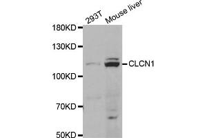 Western blot analysis of extracts of various cell lines, using CLCN1 antibody (ABIN5973365) at 1/1000 dilution.