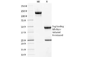SDS-PAGE Analysis Purified CD10 Mouse Monoclonal Antibody (MME/1892).