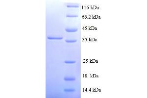 SDS-PAGE (SDS) image for NADH Dehydrogenase (Ubiquinone) 1 alpha Subcomplex, 3, 9kDa (NDUFA3) (AA 2-84) protein (GST tag) (ABIN5709997)