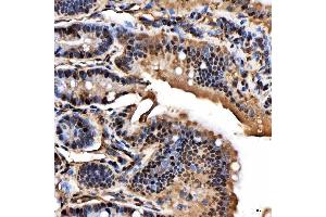 IHC analysis of SNRPA1 using anti-SNRPA1 antibody (ABIN7599131).