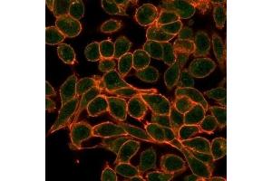 Immunofluorescence analysis of PFA-fixed HeLa cells. (MEF2B anticorps)