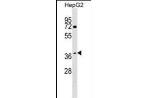 anti-DDB1 and CUL4 Associated Factor 7 (DCAF7) (AA 285-314), (C-Term) antibody