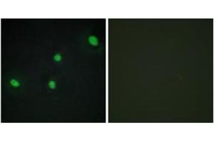Immunofluorescence analysis of HepG2 cells, using CDCA4 Antibody. (CDCA4 anticorps  (AA 121-170))