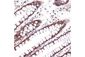Immunohistochemistry of paraffin-embedded human colon using Carbonic Anhydrase 2 (C) Rabbit mAb (ABIN7266070) at dilution of 1:100 (40x lens). (CA2 anticorps)