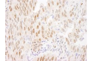 Immunohistochemistry (IHC) image for anti-Forkhead Box O3 (FOXO3) (C-Term) antibody (ABIN7448571)