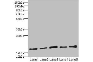 Western blot All lanes: PPIL3 antibody at 10 μg/mL Lane 1: U87 whole cell lysate Lane 2: HL60 whole cell lysate Lane 3: K562 whole cell lysate Lane 4: THP-1 whole cell lysate Lane 5: A549 whole cell lysate Secondary Goat polyclonal to rabbit IgG at 1/10000 dilution Predicted band size: 19 kDa Observed band size: 19 kDa (PPIL3 anticorps  (AA 2-161))