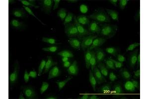Immunofluorescence of monoclonal antibody to RALGPS2 on HeLa cell.