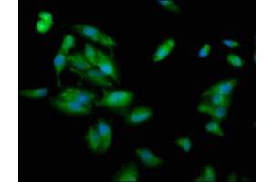 Immunofluorescence staining of Hela cells with ABIN7163687 at 1:100, counter-stained with DAPI. (PLEC anticorps  (AA 1744-1929))