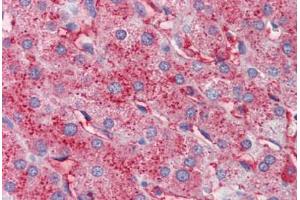 Human Liver (formalin-fixed, paraffin-embedded) stained with APOC3 antibody ABIN462267 followed by biotinylated anti-goat IgG secondary antibody ABIN481715, alkaline phosphatase-streptavidin and chromogen. (APOC3 anticorps)