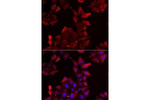 Immunofluorescence analysis of U2OS cells using PDLIM1 antibody.