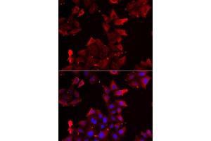 Immunofluorescence analysis of U2OS cells using PDLIM1 antibody. (PDLIM1 anticorps  (AA 1-329))