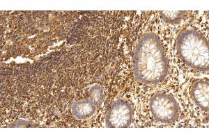 Detection of IL17 in Human Rectum Tissue using Monoclonal Antibody to Interleukin 17 (IL17)