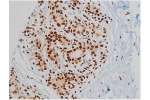 ABIN6267385 at 1/200 staining Human heart tissue sections by IHC-P.