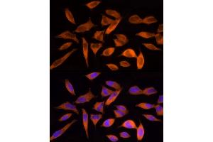 Immunofluorescence analysis of HeLa cells using ACLY Rabbit pAb (ABIN7265716) at dilution of 1:250 (40x lens). (ACLY anticorps  (AA 752-1101))